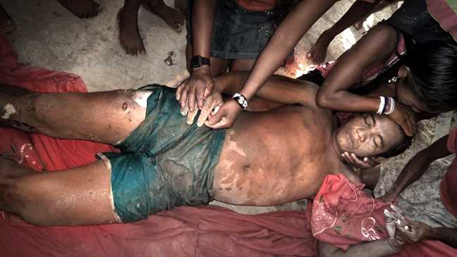 Adenilson Kirixi Munduruku: três tiros nas pernas e um tiro na cabeça