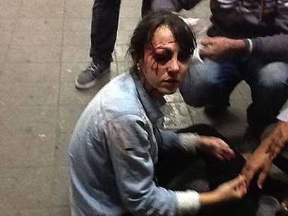 Giuliana Vallone, da TV Folha, atingida no olho por uma bala de borracha de policiais militares da Rota (Diego Zanchetta/Estadão Conteúdo)