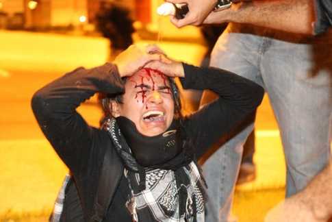 Mulher ficou ferida na região da cabeça e foi amparada por outros manifestantes