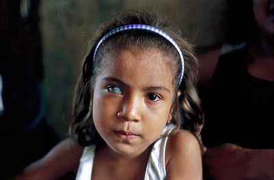 Pamela Rodriguez. A pequena indígena do Equador nasceu com má formação em um de seus olhos numa comunidade com ocorrência extremamente elevada de aborto, câncer e má formação congênita.
